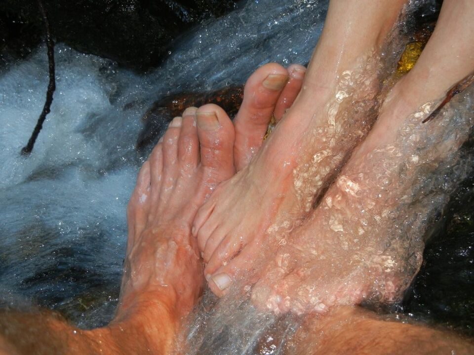 Myosis of the nails of the legs